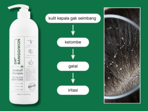Ketombe Bukan Cuma Soal Serpihan Putih di Bahu